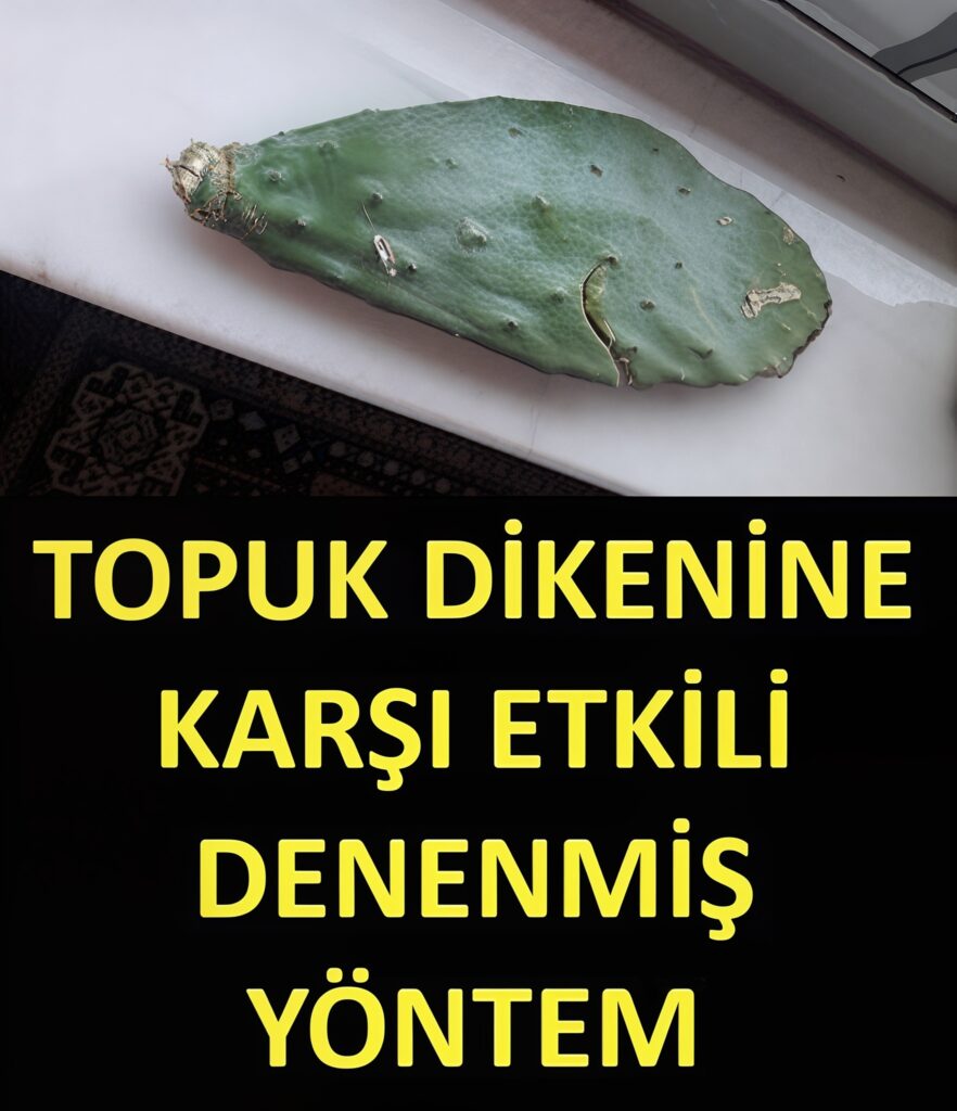 Topuk Dikeni Rahatsızlığına Karşı Denenmiş Bitkisel ve Doğal Çözümler