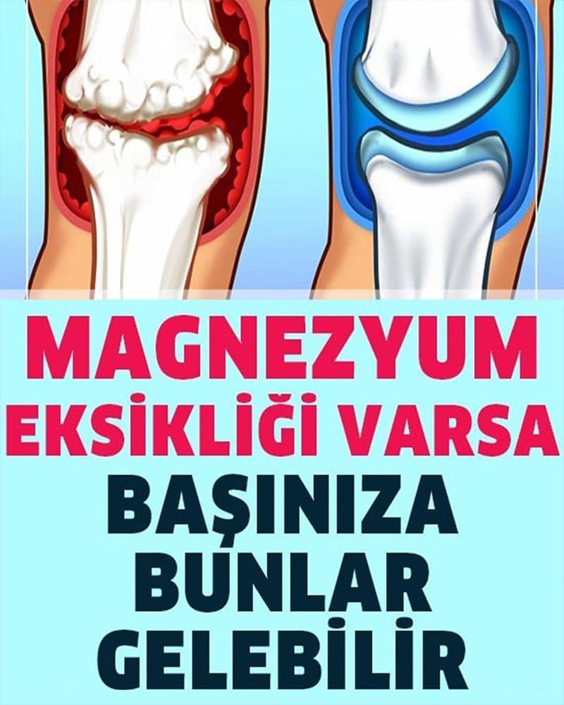Magnezyum Eksikliğinin 13 İşareti