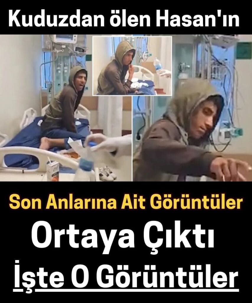 Kuduz Teşhisi Konulan Suriyeli Çocuk