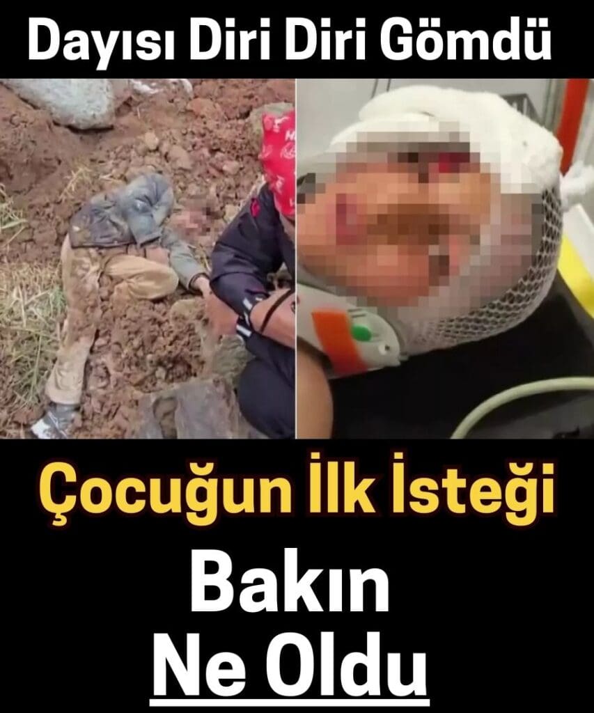 Dayısının Diri Diri Toprağa Gömdüğü Çocuğun İlk İsteği “Su” Oldu