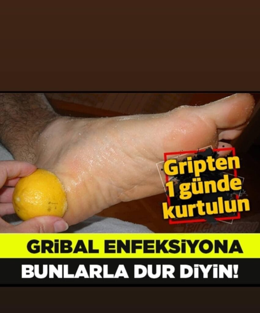 Gribal Enfeksiyonla Mücadelede Limon Kullanım Yolları